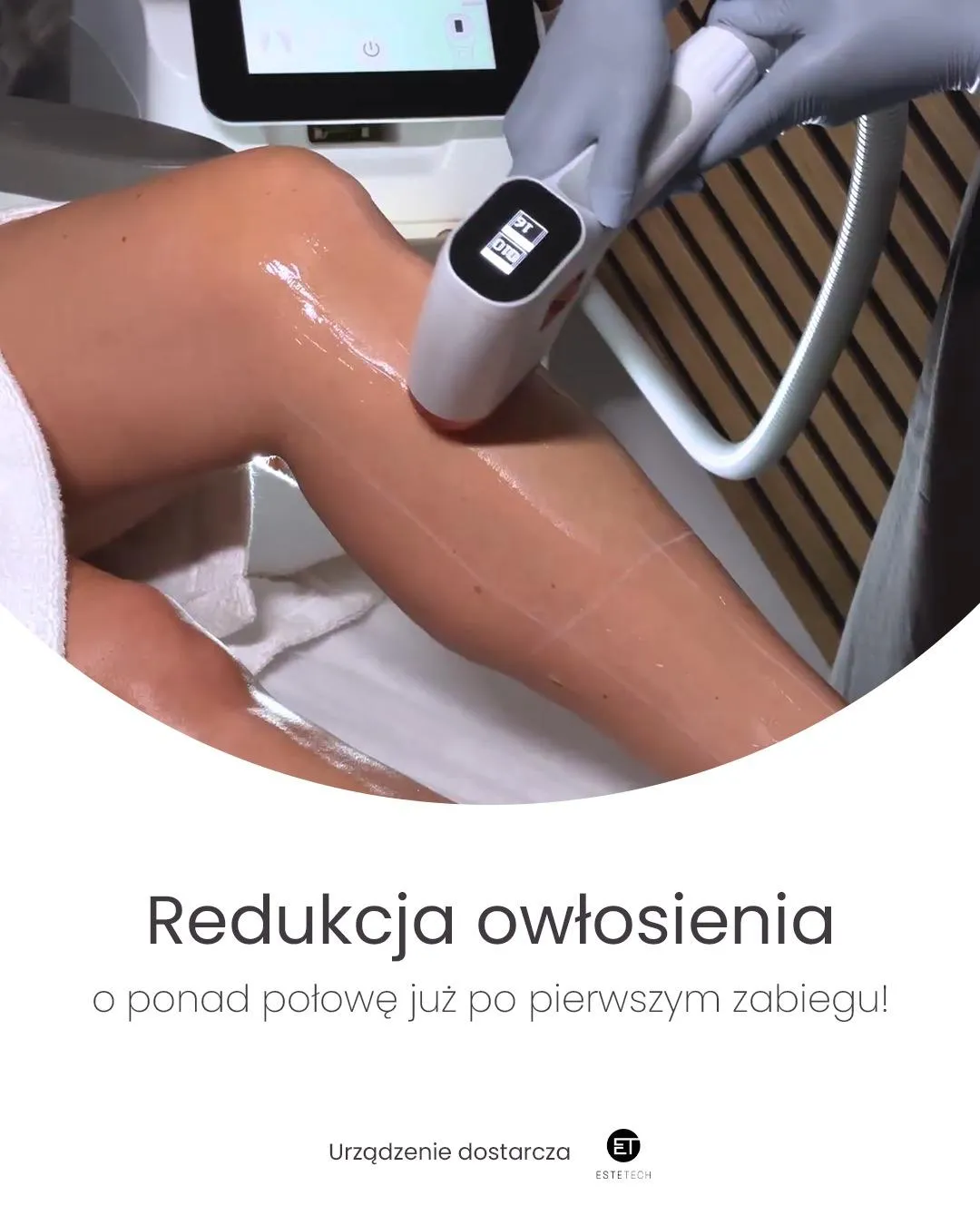 Redukcja niedoskonałości