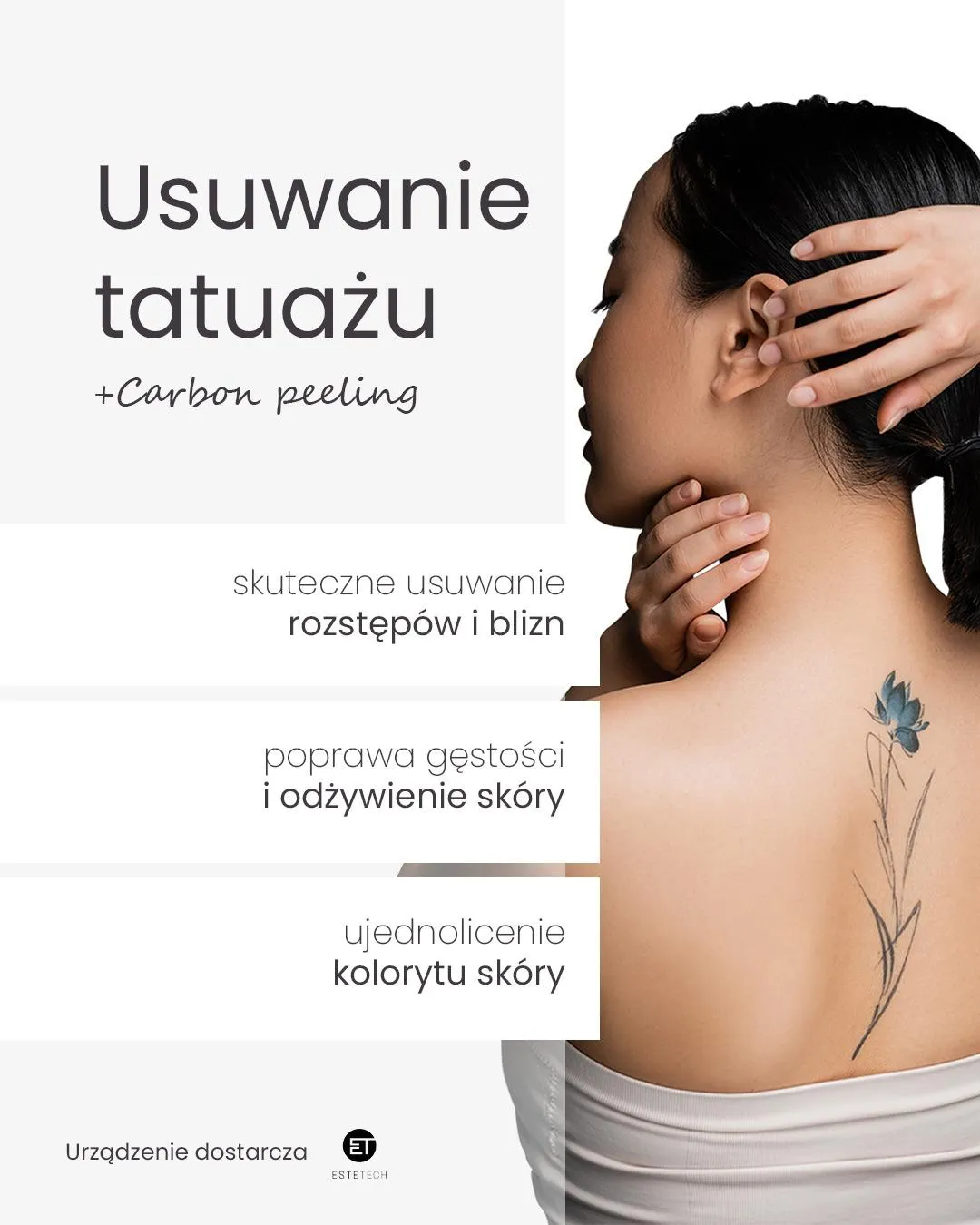 Usuwanie tatuażu